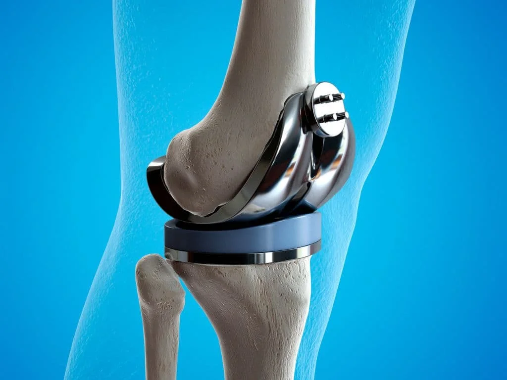 Orthopedic Industry